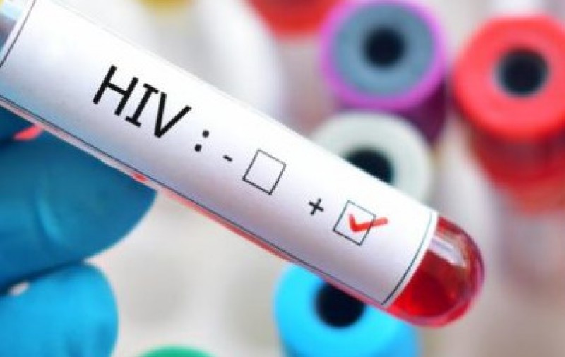 Governo reduz tarifa de importação de medicamentos de HIV/Aids